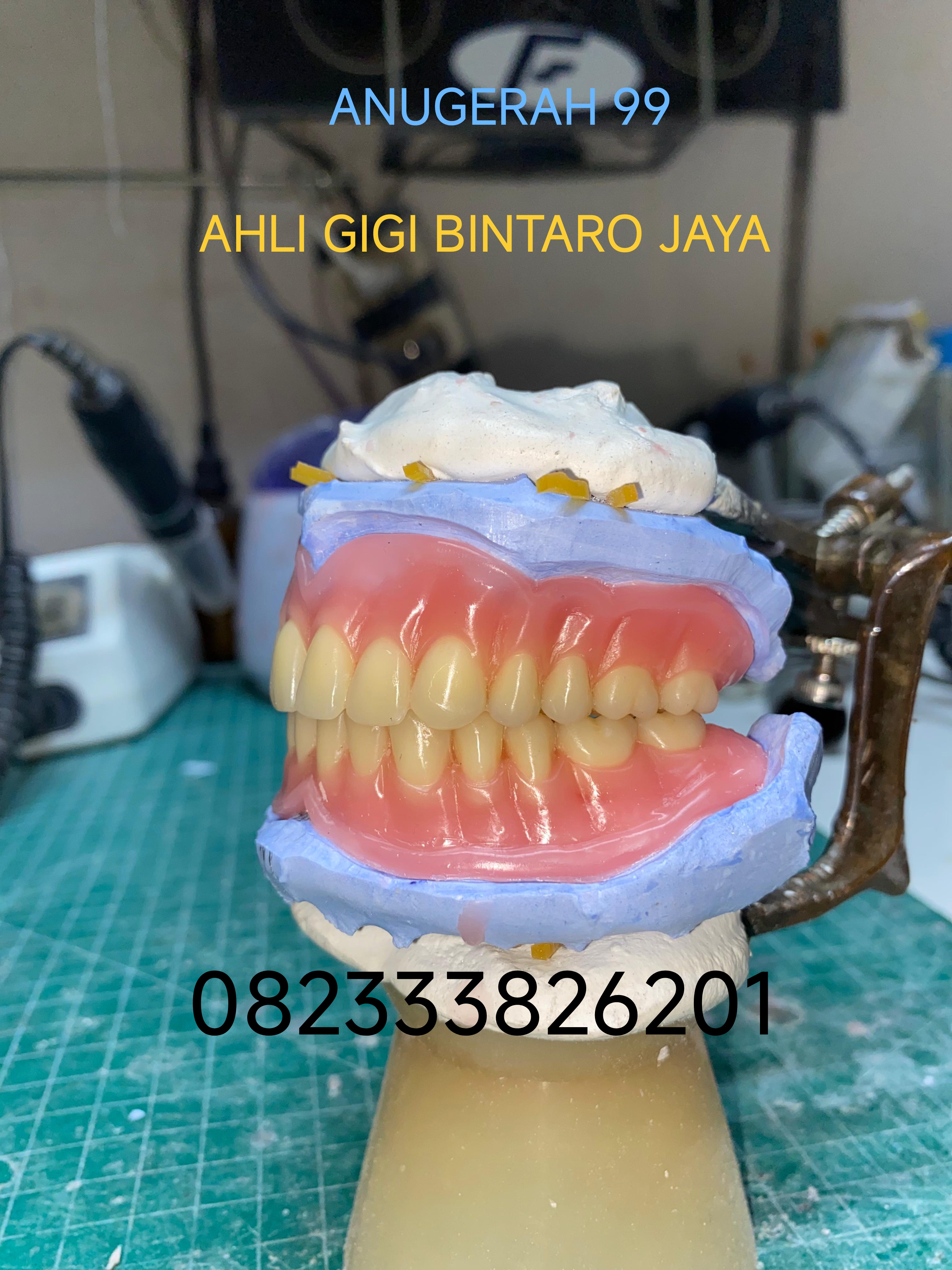 Konsultasi seputar gigi palsu
